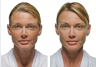 Before & After Photos